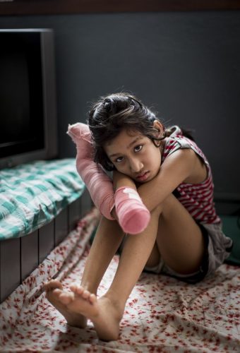 Nepal, 18 may 2015.Prashna Shrestha is a 9yo Nepali girl from Kathmandu, very bright, excited about math and engineering, and already programming simple computer code. She wishes to be a computer engineer. 
She was praying in her Hindu temple when the first earthquake struck on 25 April. The temple collapsed, trapping her and, as she fell forward, a large stone landed on her outstretched hands. 
Her right hand suffered a traumatic crush amputation at the wrist and so her right hand is gone. Her left hand lost her entire middle and ring fingers. 
Her mother and father are very supportive and at her bedside. Prashna is already learning to use her toes on her doctor’s iPad